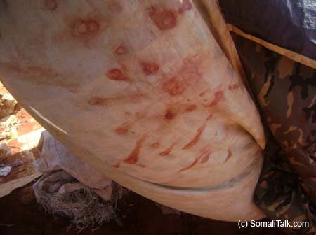 Dhiig ka muuqda marada taasi oo u muuqata in dhibaato badani ay soo gaartey